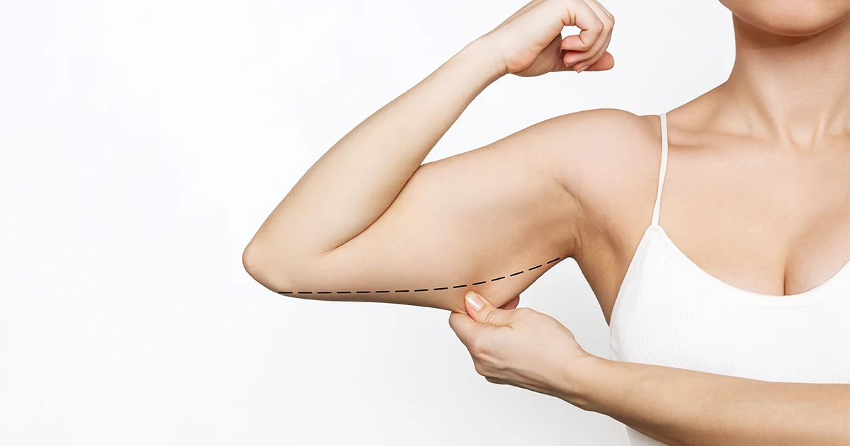 Marcación de Brazos